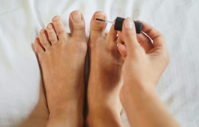 Uñas de los pies sanas y de color rosado uniforme, sin alteraciones.