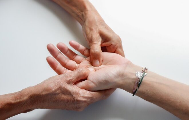 Mano de paciente tratada por fisioterapeuta para aliviar el síndrome del túnel carpiano y el dolor en la muñeca.